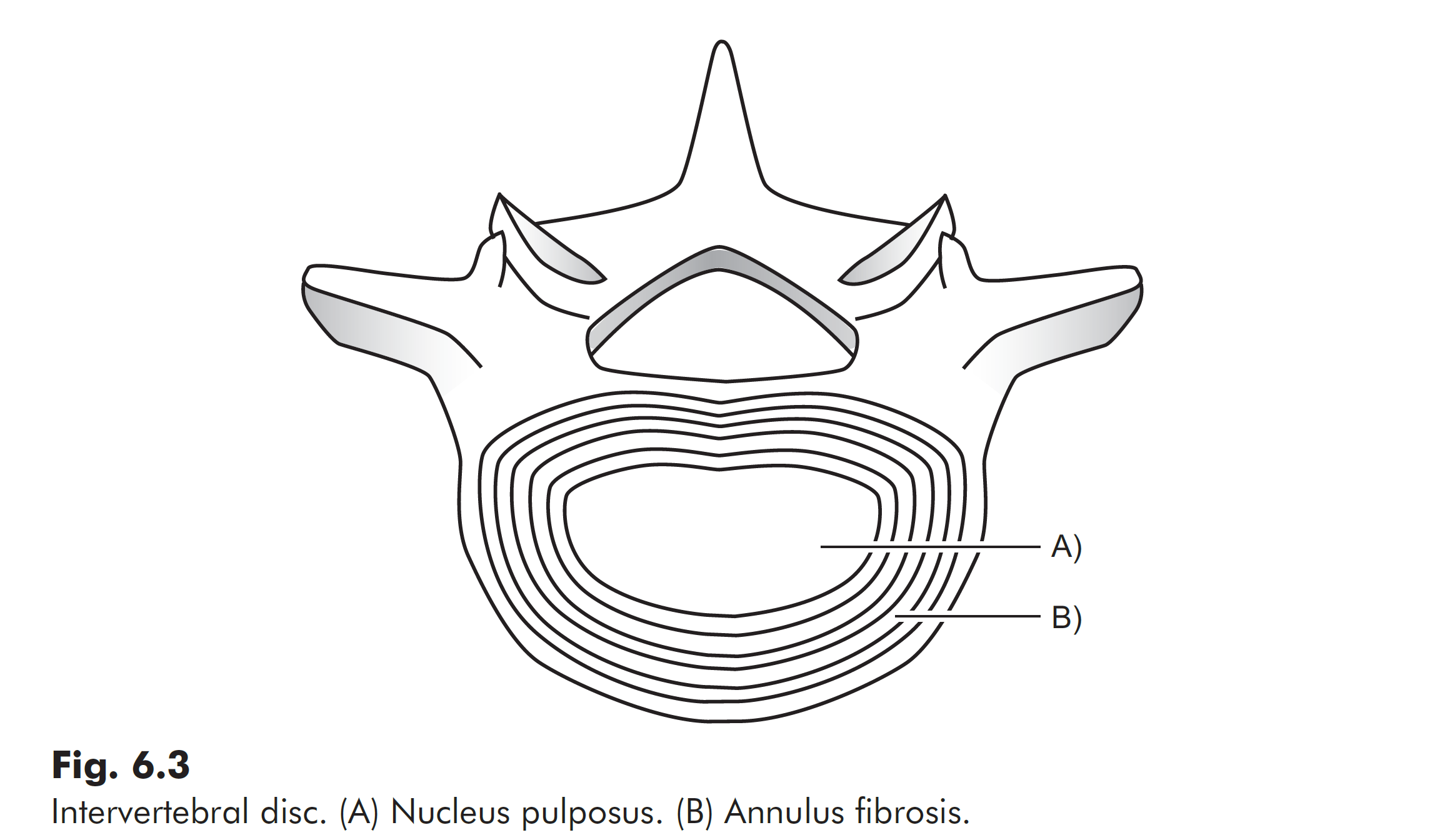 A sketch of a vertebral disc pointing to the nucleus pulposus and the annulus fibrosis